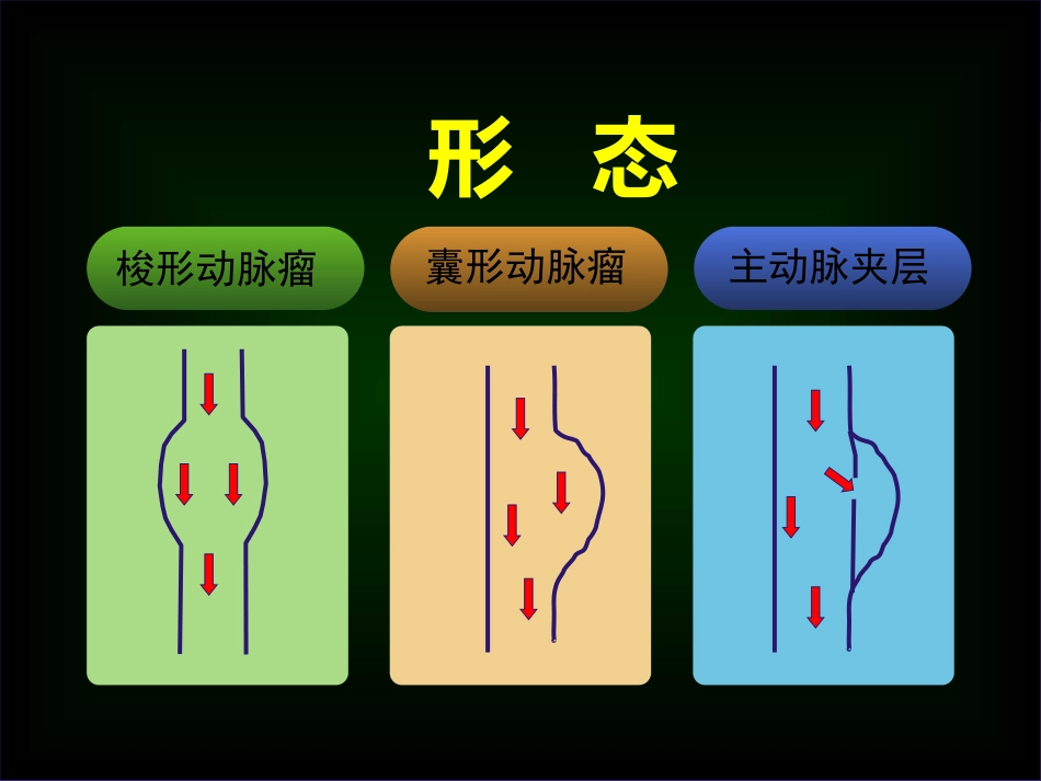 主动脉外科_第11页
