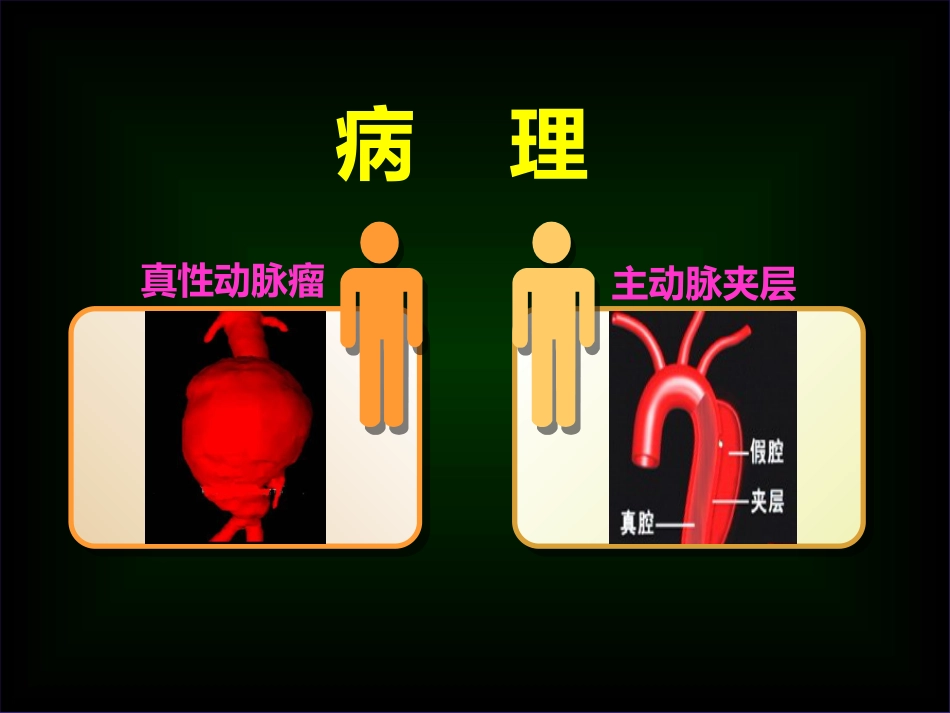 主动脉外科_第13页