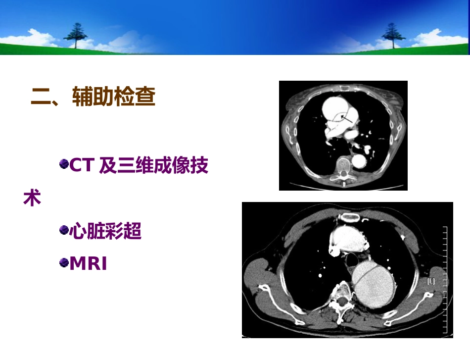 主动脉外科_第15页