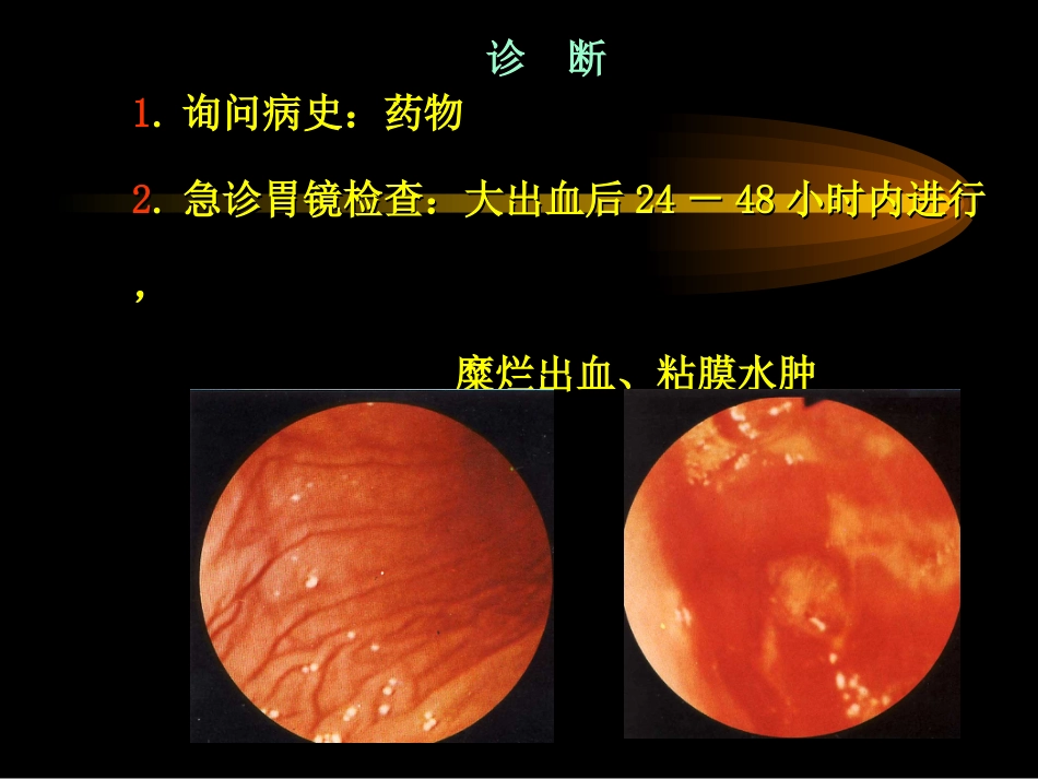 胃炎_第12页