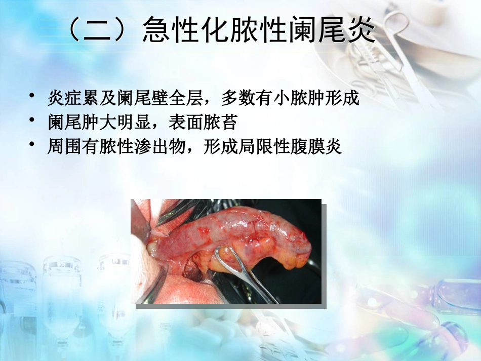 胃肠外科-阑尾炎、结直肠肛管疾病_第10页