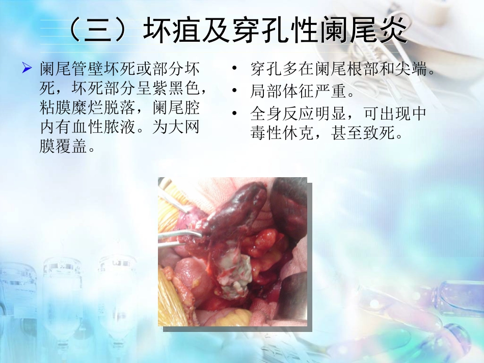 胃肠外科-阑尾炎、结直肠肛管疾病_第11页