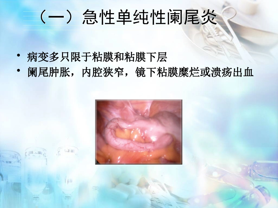 胃肠外科-阑尾炎、结直肠肛管疾病_第9页