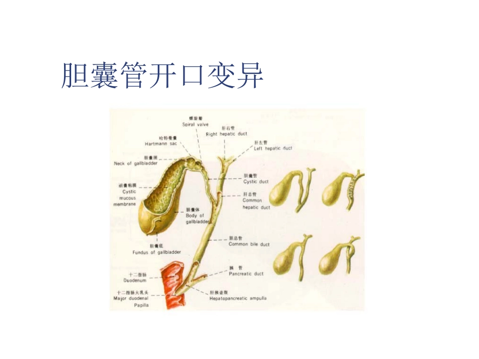 外科-胆囊结石及其防治_第3页