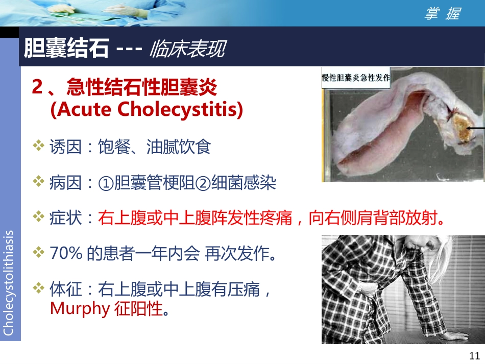外科-胆囊结石讲课比赛_第11页