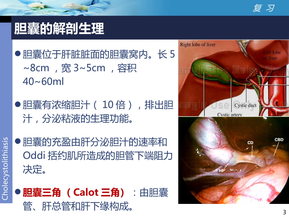 外科-胆囊结石讲课比赛_第3页