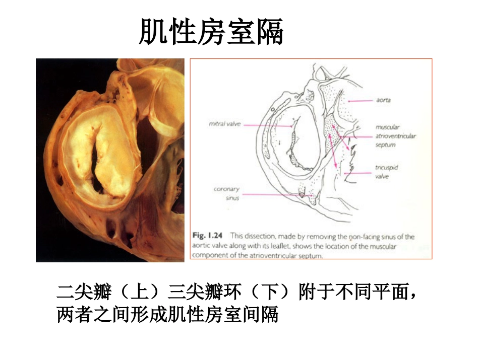 心脏外科-解剖讲义_第10页