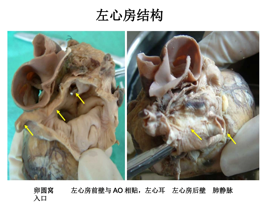 心脏外科-解剖讲义_第12页