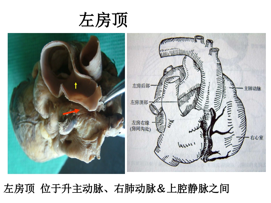 心脏外科-解剖讲义_第13页