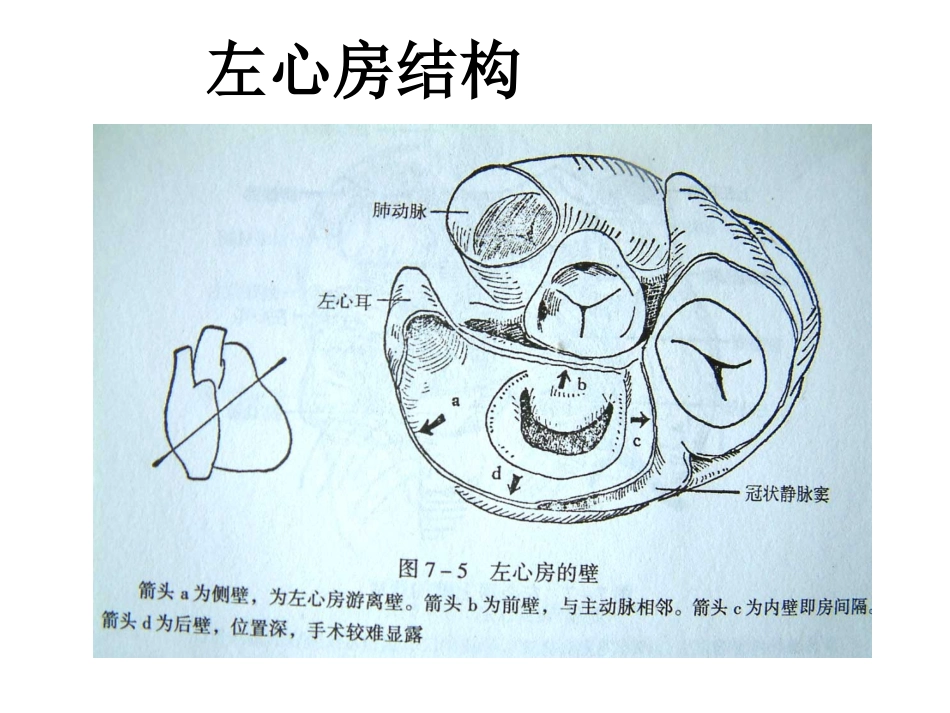 心脏外科-解剖讲义_第14页