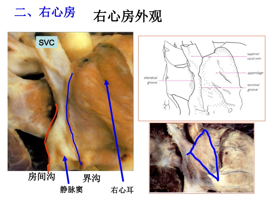 心脏外科-解剖讲义_第6页