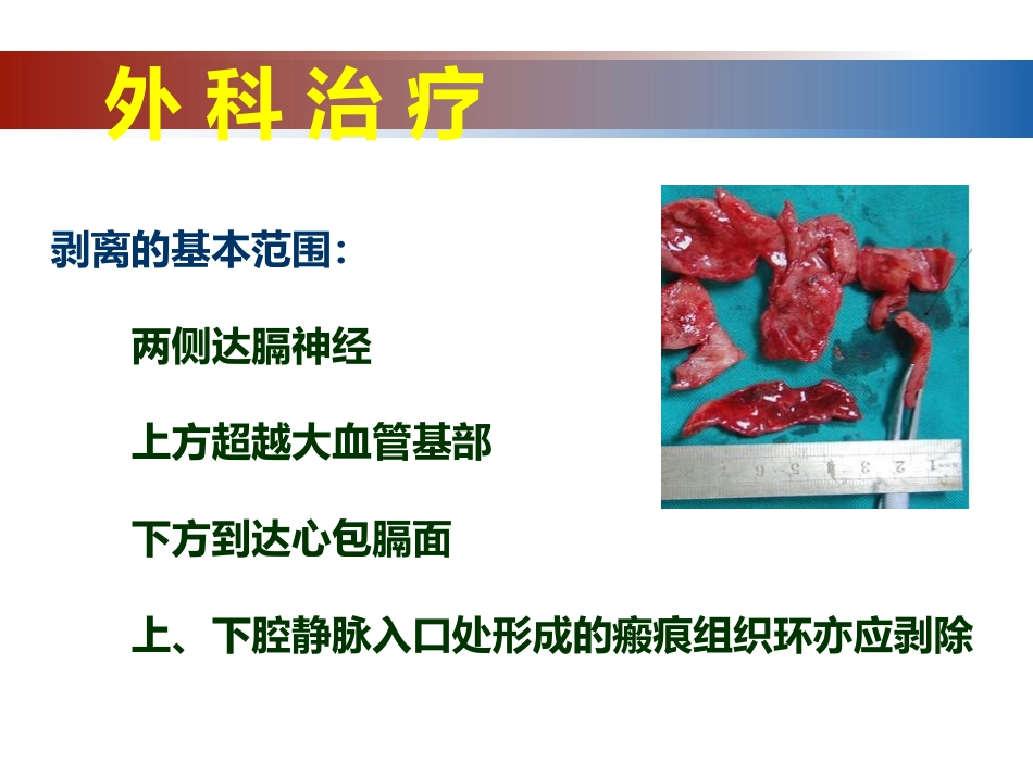 心脏外科_第12页