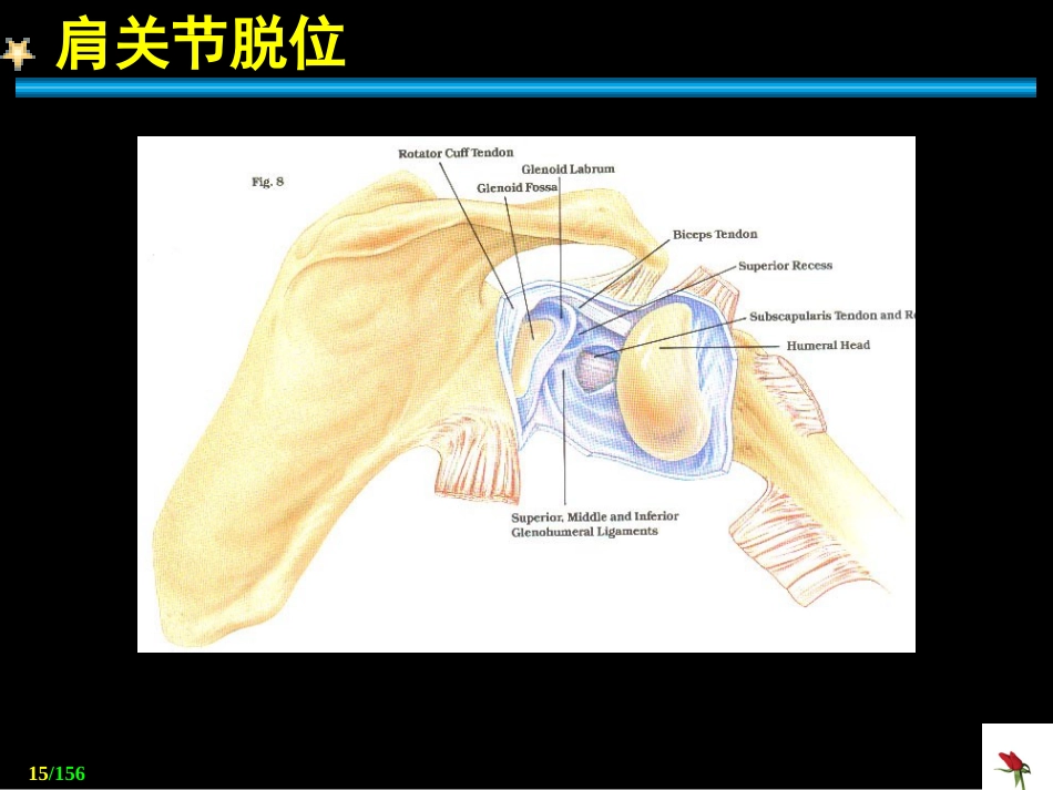 关节 脱位_第15页