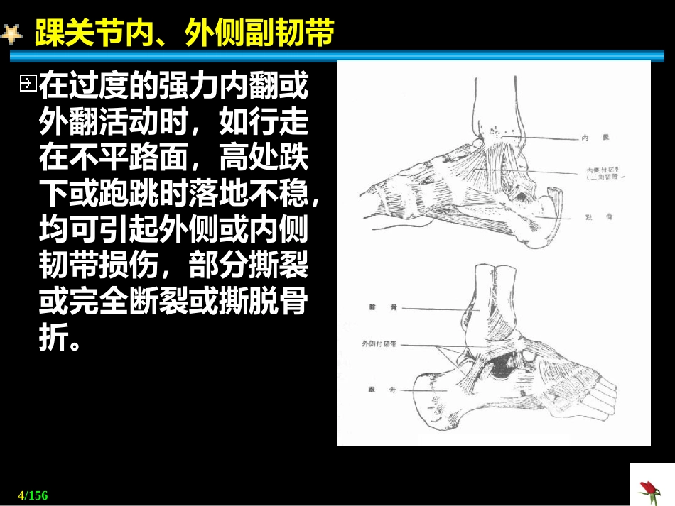 关节 脱位_第4页