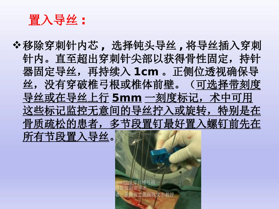 经皮椎弓根 钉置入技术_第13页