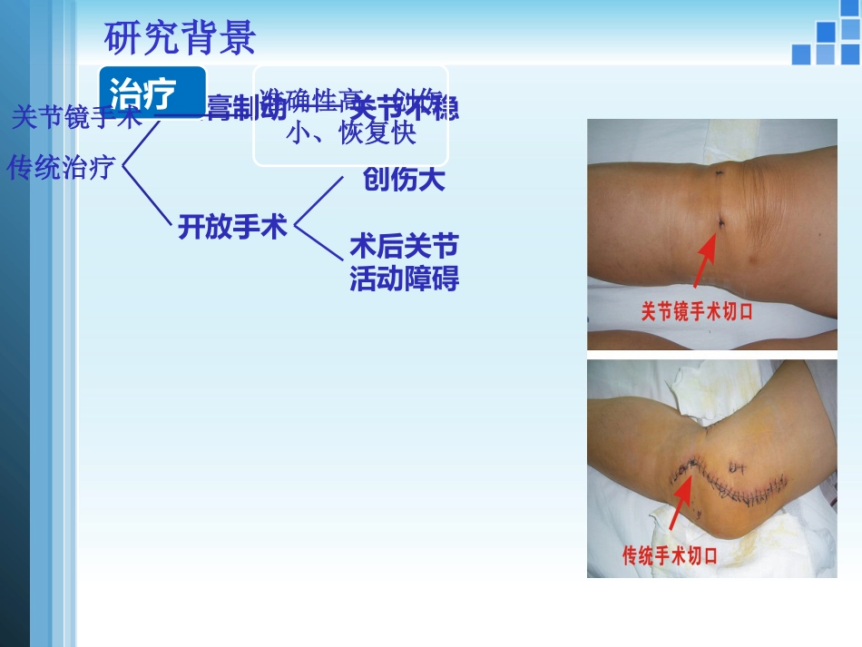 关节镜膝关节 多发韧带损伤的修复_第8页