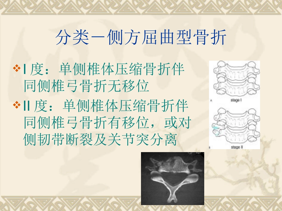 颈椎骨 折_第10页