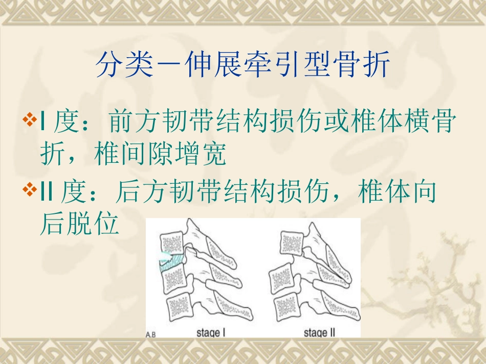 颈椎骨 折_第11页