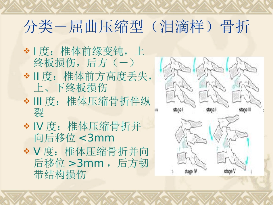 颈椎骨 折_第6页