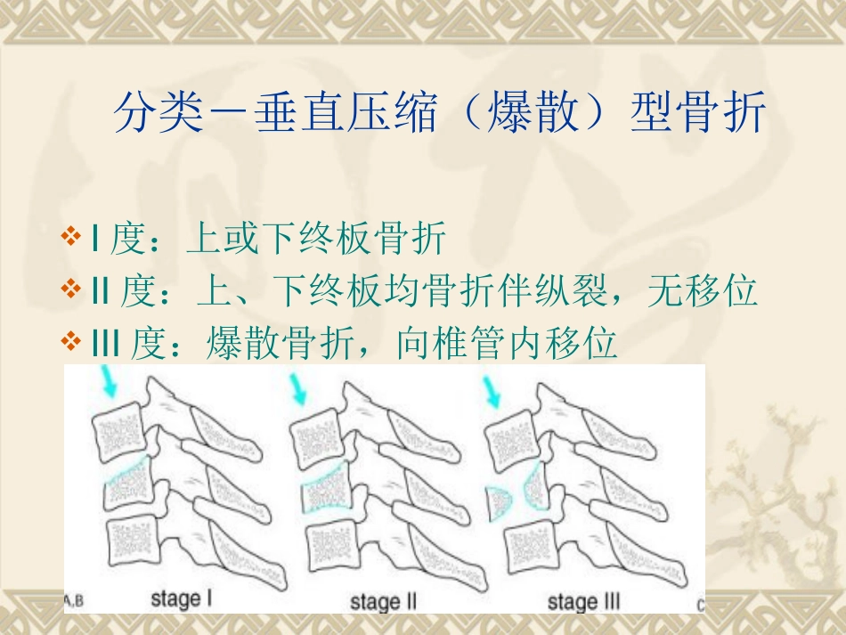 颈椎骨 折_第7页