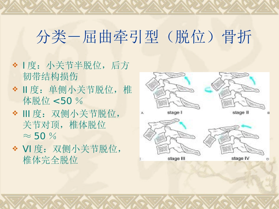 颈椎骨 折_第9页