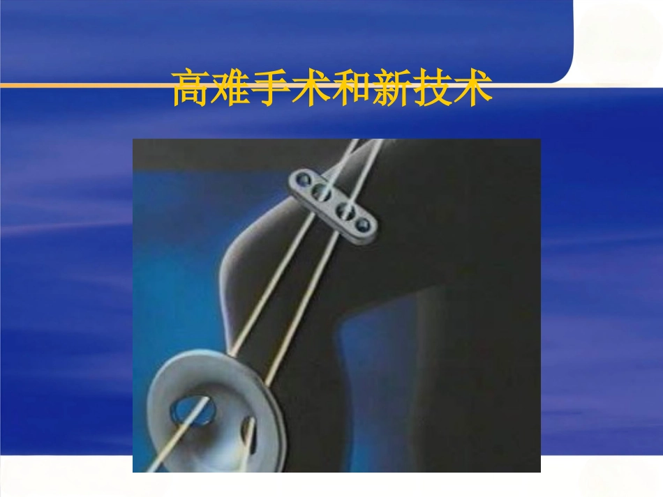 关节镜 基本知识_第10页