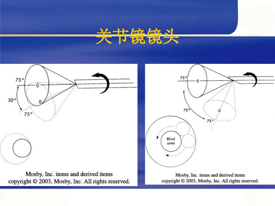 关节镜 基本知识_第13页
