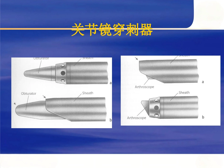 关节镜 基本知识_第15页