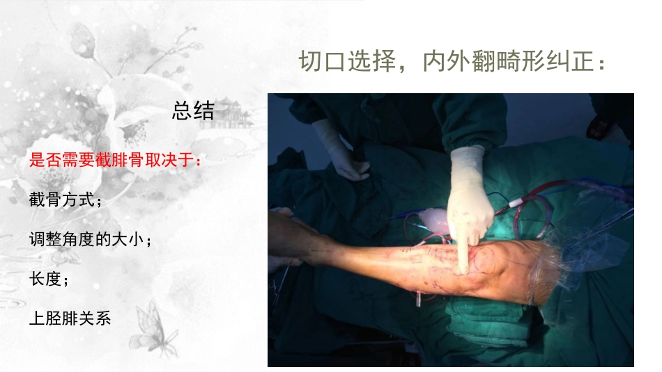 截骨术在不稳定 膝关节的作用_第12页