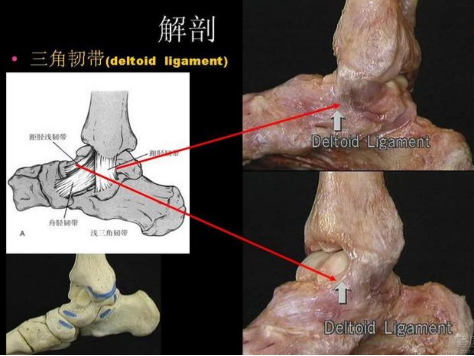 踝关节骨折Lauge-hansen分 型的理解与评价_第2页