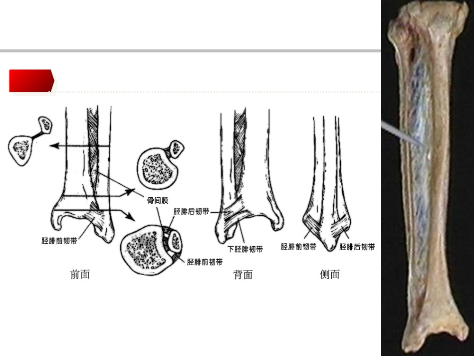 踝关节骨折Lauge-hansen分 型的理解与评价_第6页
