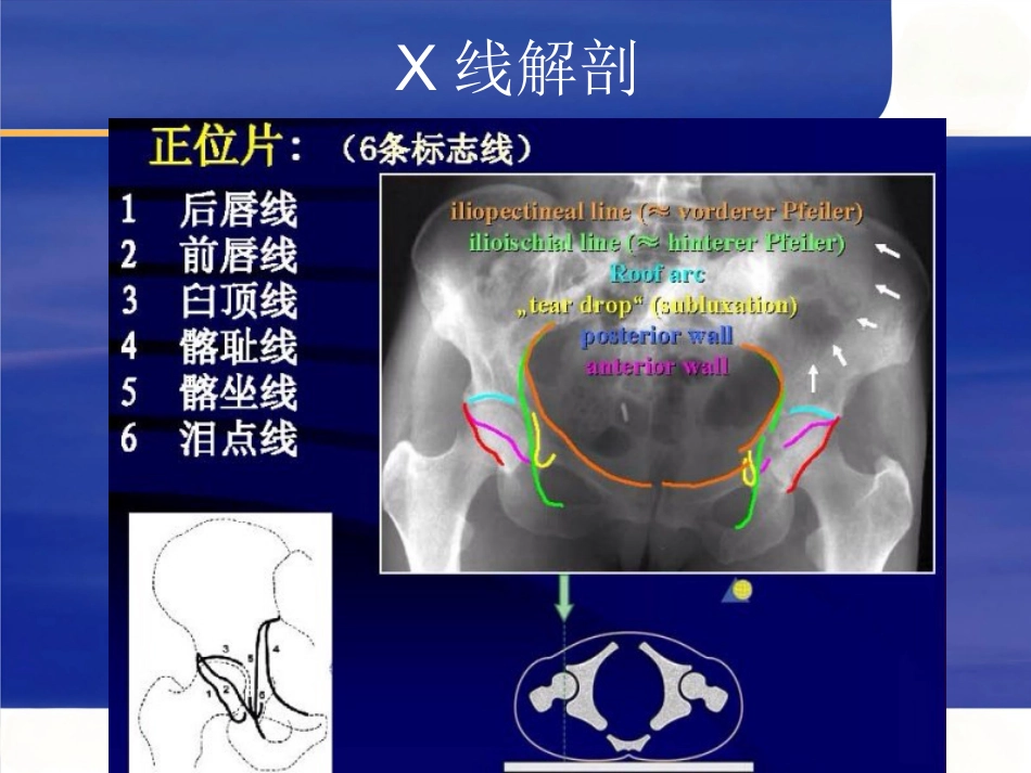 髋臼骨折的 诊断及治疗_第6页