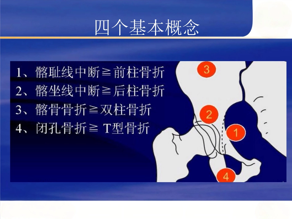 髋臼骨折的 诊断及治疗_第9页