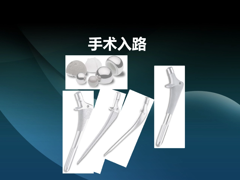 髋部解剖及 手术入路_第14页