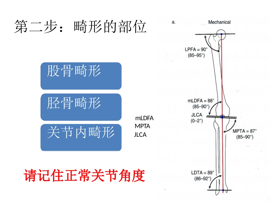 截骨术前 设计_第10页