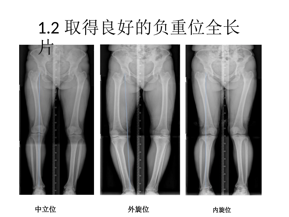 截骨术前 设计_第4页