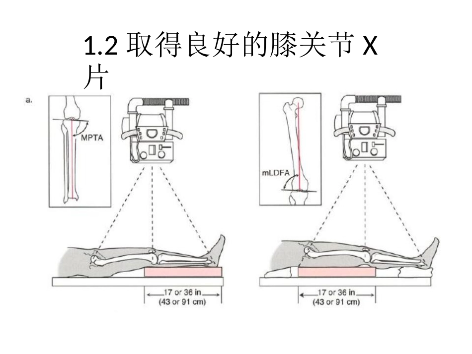 截骨术前 设计_第6页