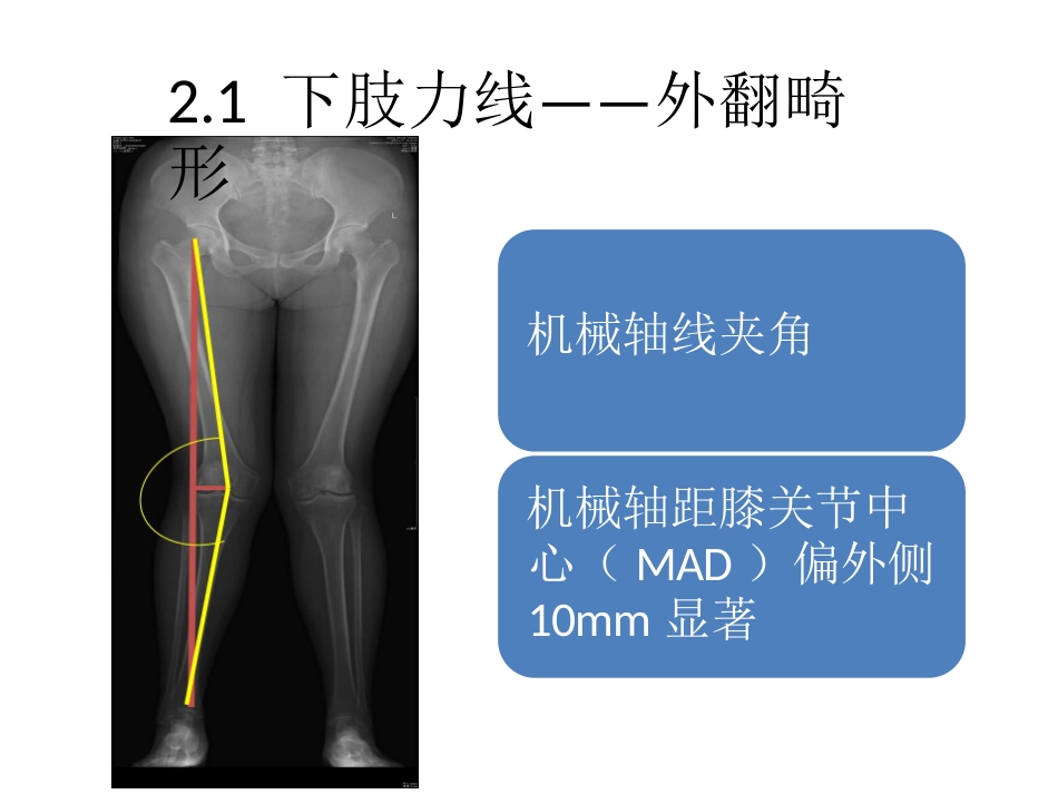 截骨术前 设计_第9页
