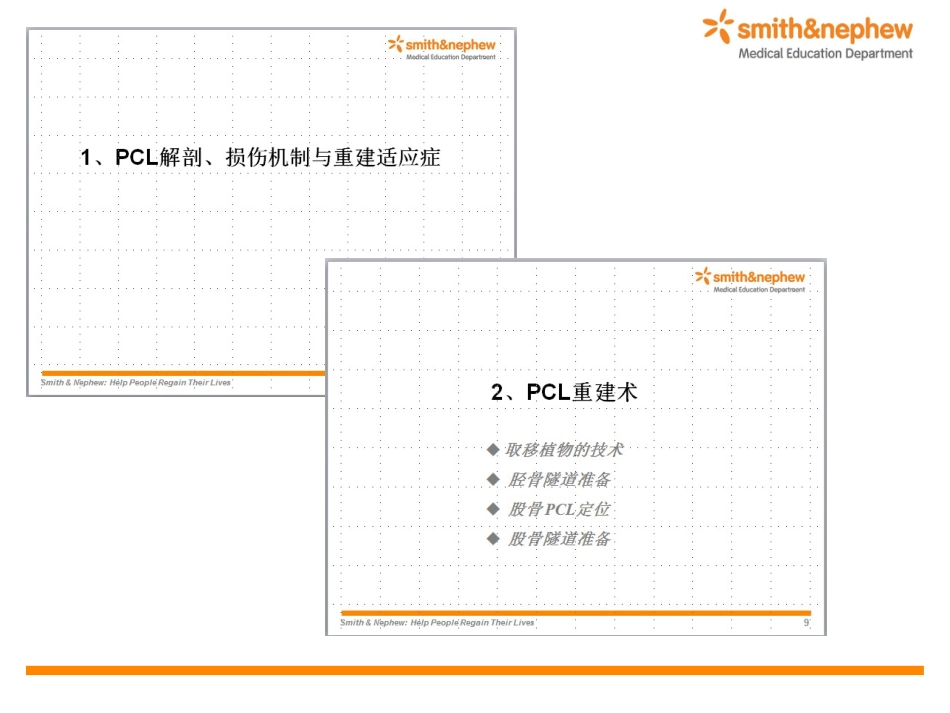 后交叉韧带重 建术_第2页