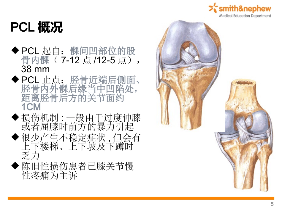 后交叉韧带重 建术_第5页