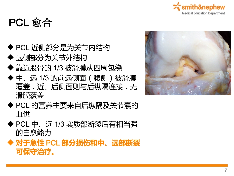 后交叉韧带重 建术_第7页