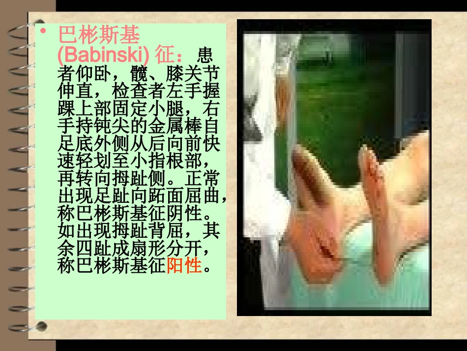 颈脊髓损伤课件_第15页