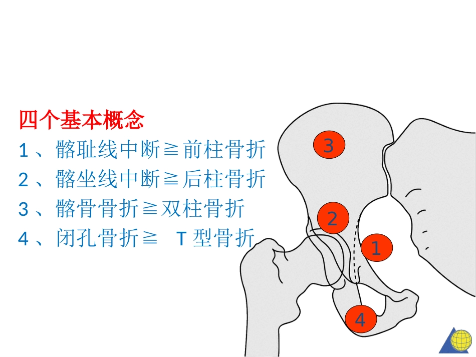 髋臼骨折基 础知识_第11页