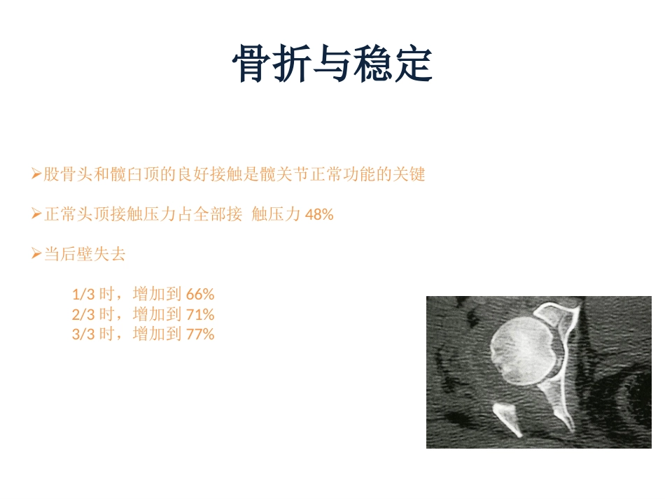 髋臼骨折基 础知识_第4页