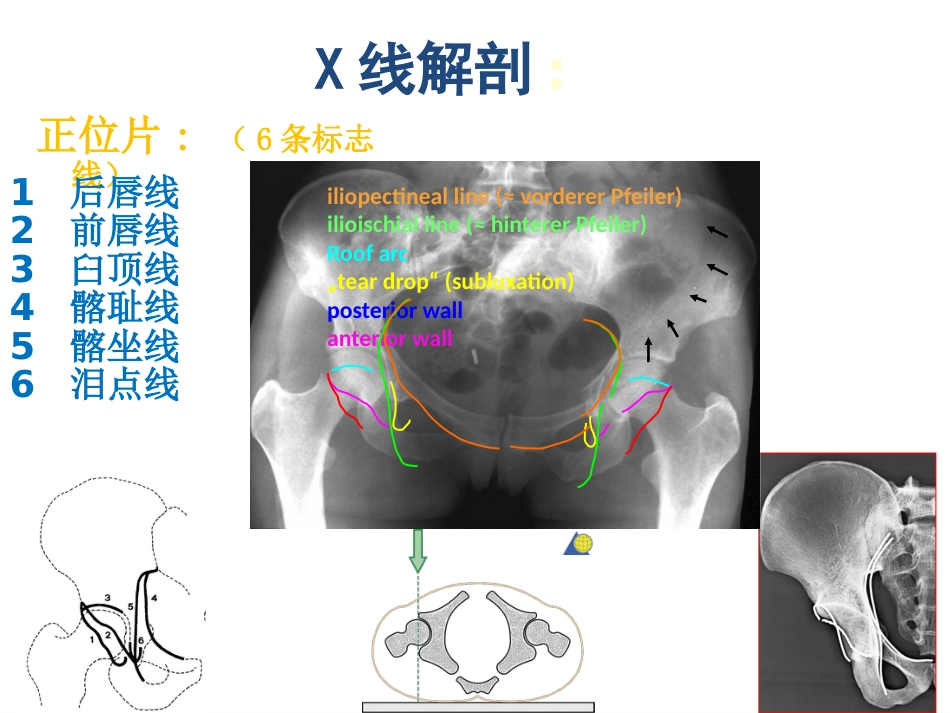 髋臼骨折基 础知识_第8页
