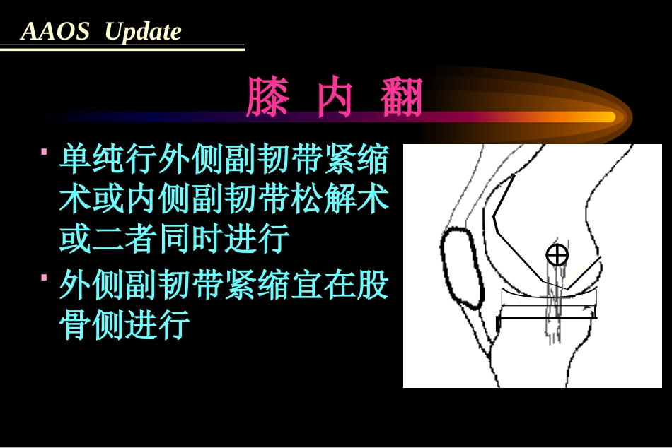 全膝关节置 换术软组织平衡_第11页