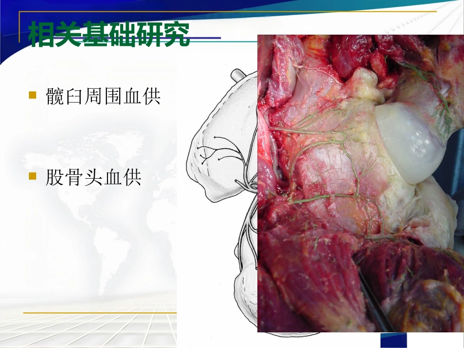髋臼周围截骨术治疗成人髋 关节发育不良_第15页