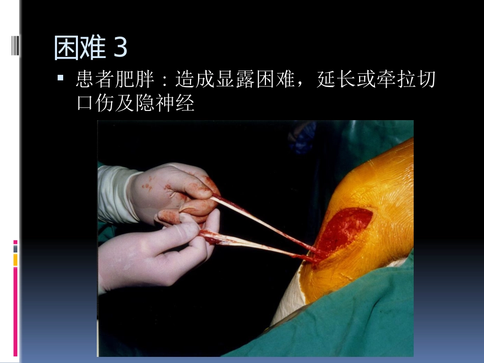 前交叉韧带重建中后侧小切口 腘绳肌腱取腱方法_第7页