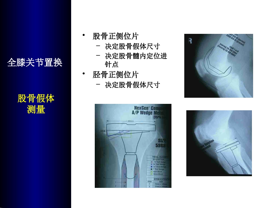 全膝关 节置换术培训_第10页
