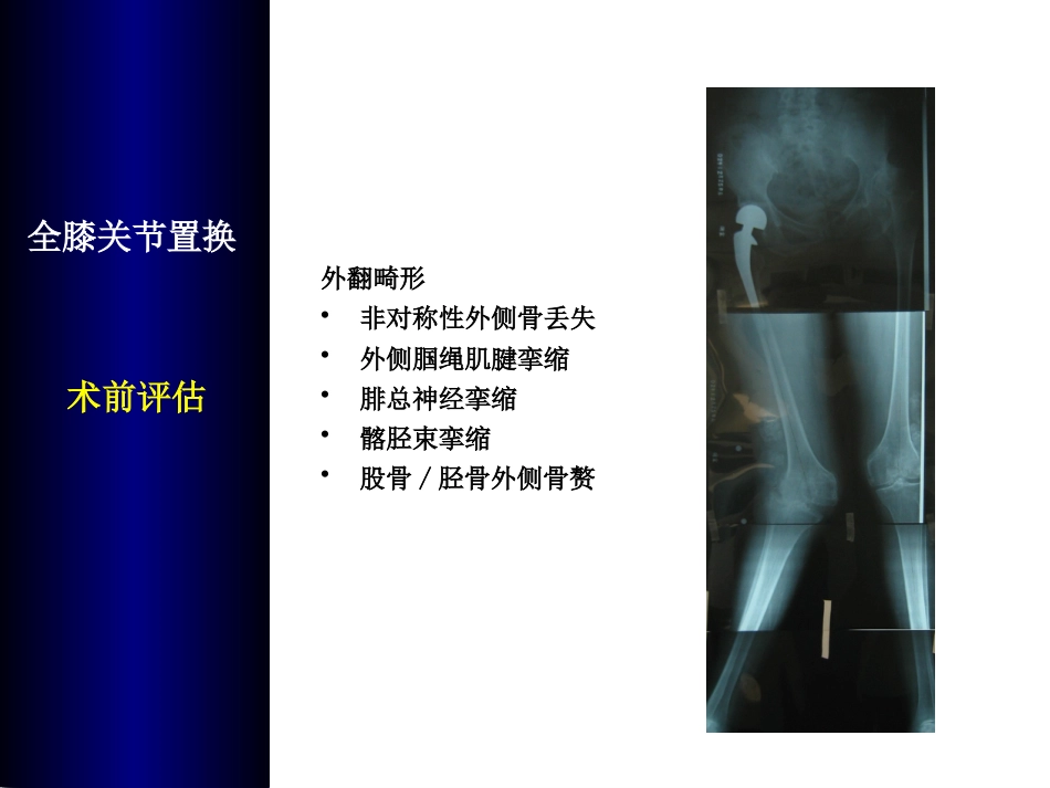 全膝关 节置换术培训_第7页